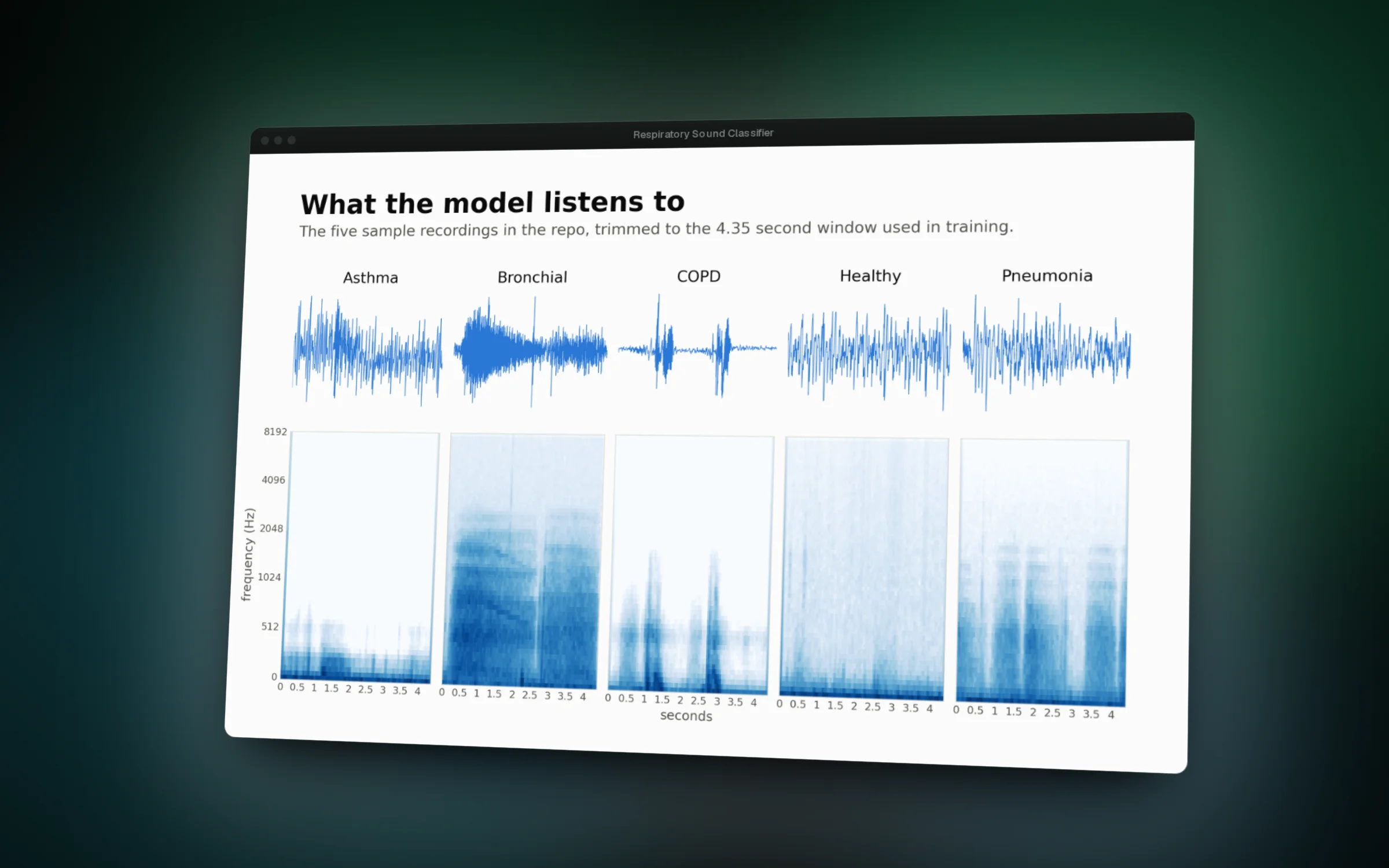 Each condition leaves a different pattern in the sound